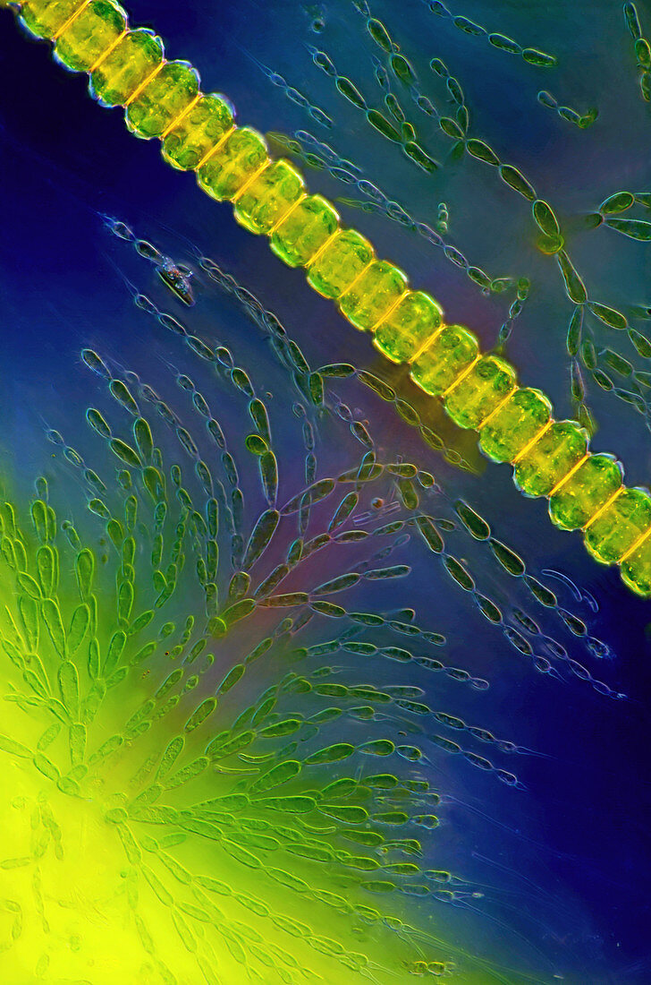 Desmids and red algae,light micrograph
