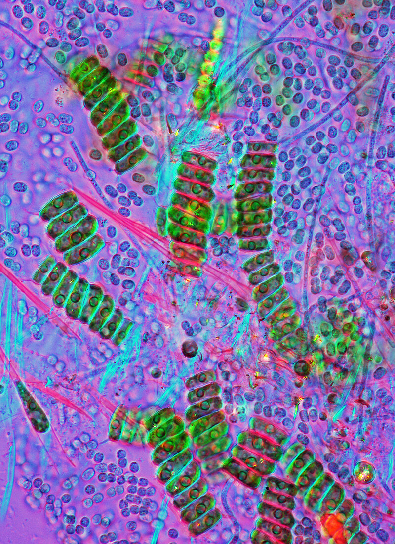 Scenedesmus green algae,light micrograph