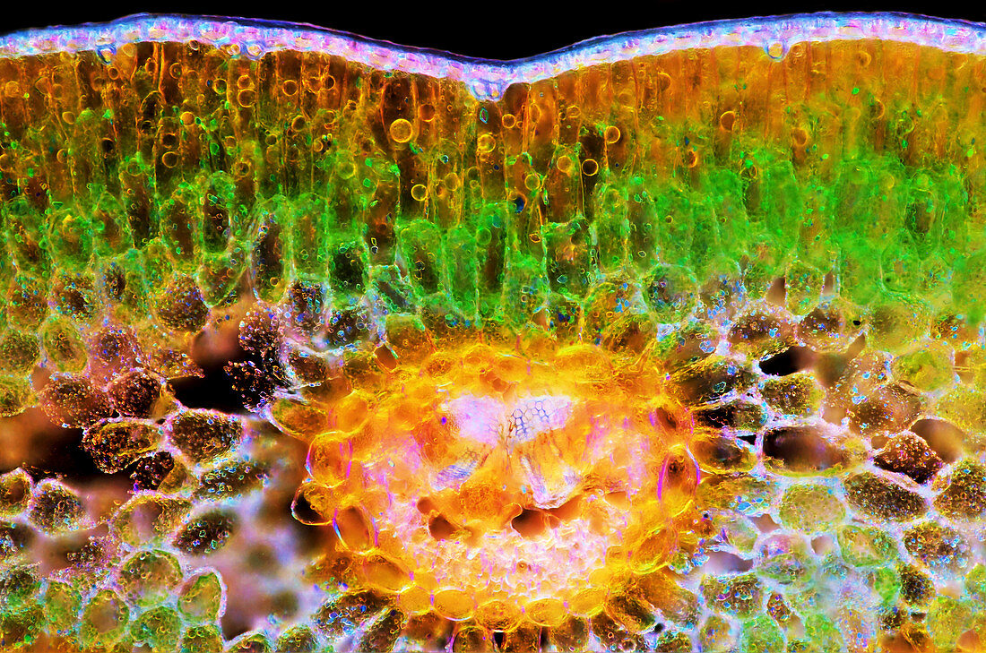 Yew needle,light micrograph