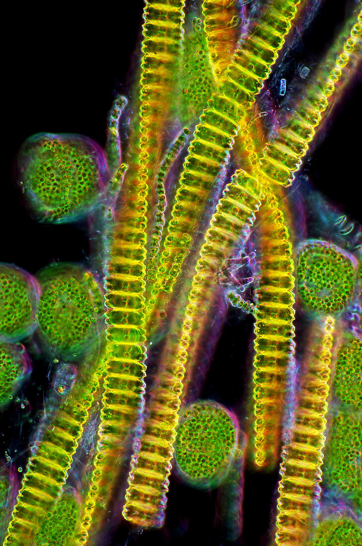 Protozoa and desmids,light micrograph
