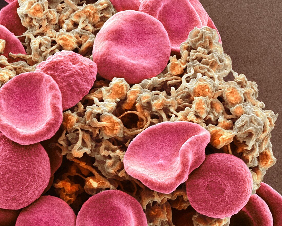 Red blood cells and platelets,SEM