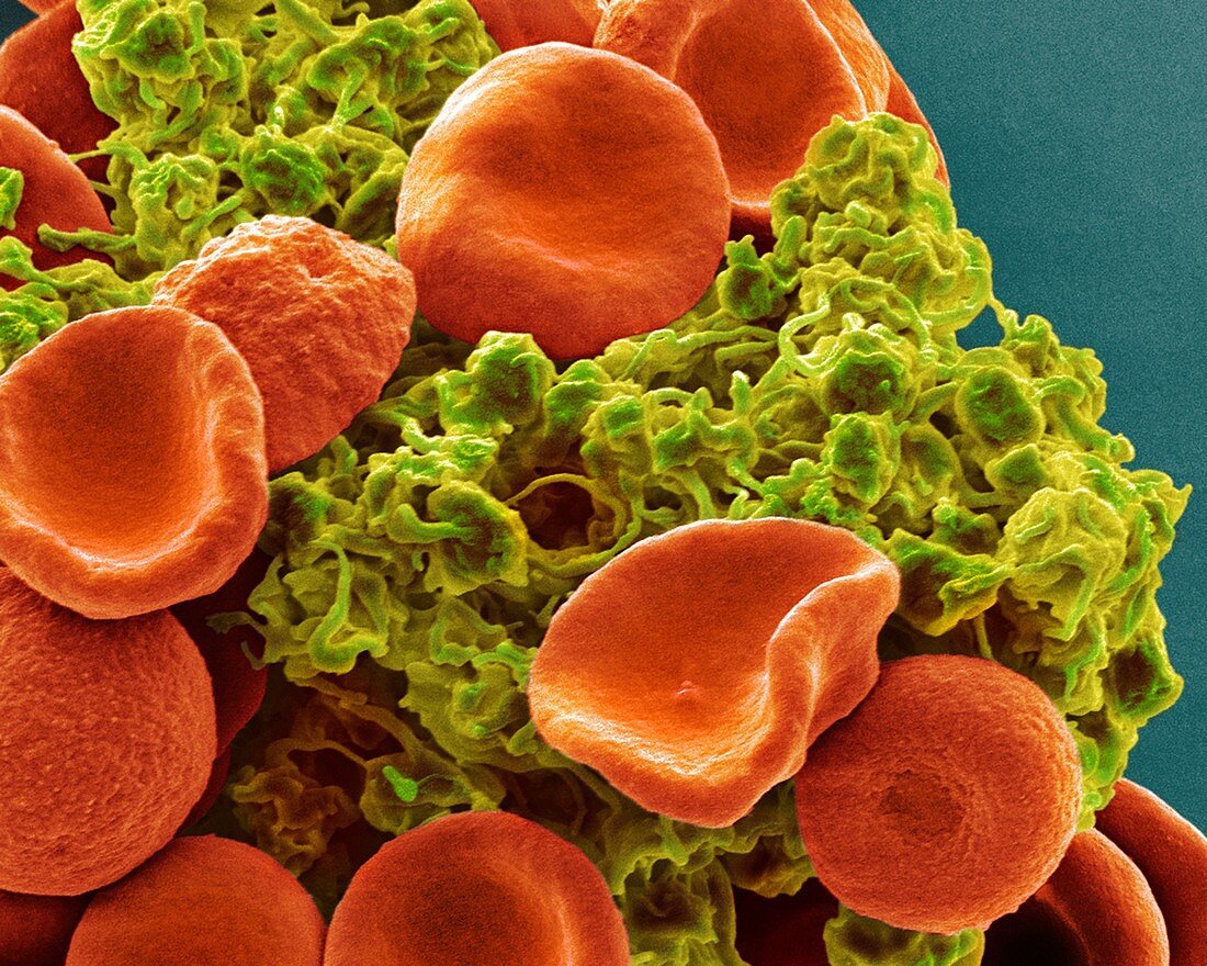 Red blood cells and platelets,SEM