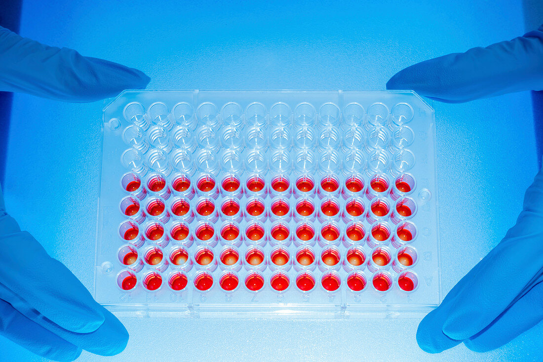 Microbiology samples in multiwell tray