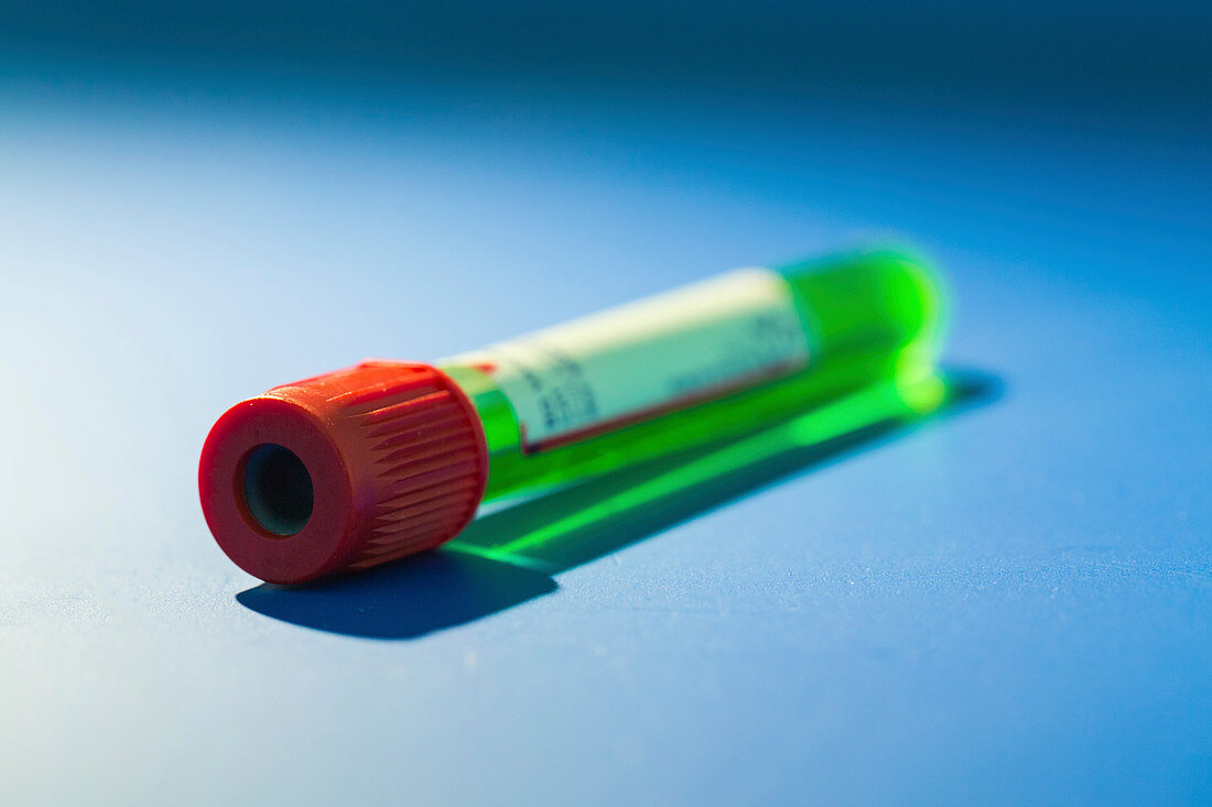 Vacutainer tube with green liquid