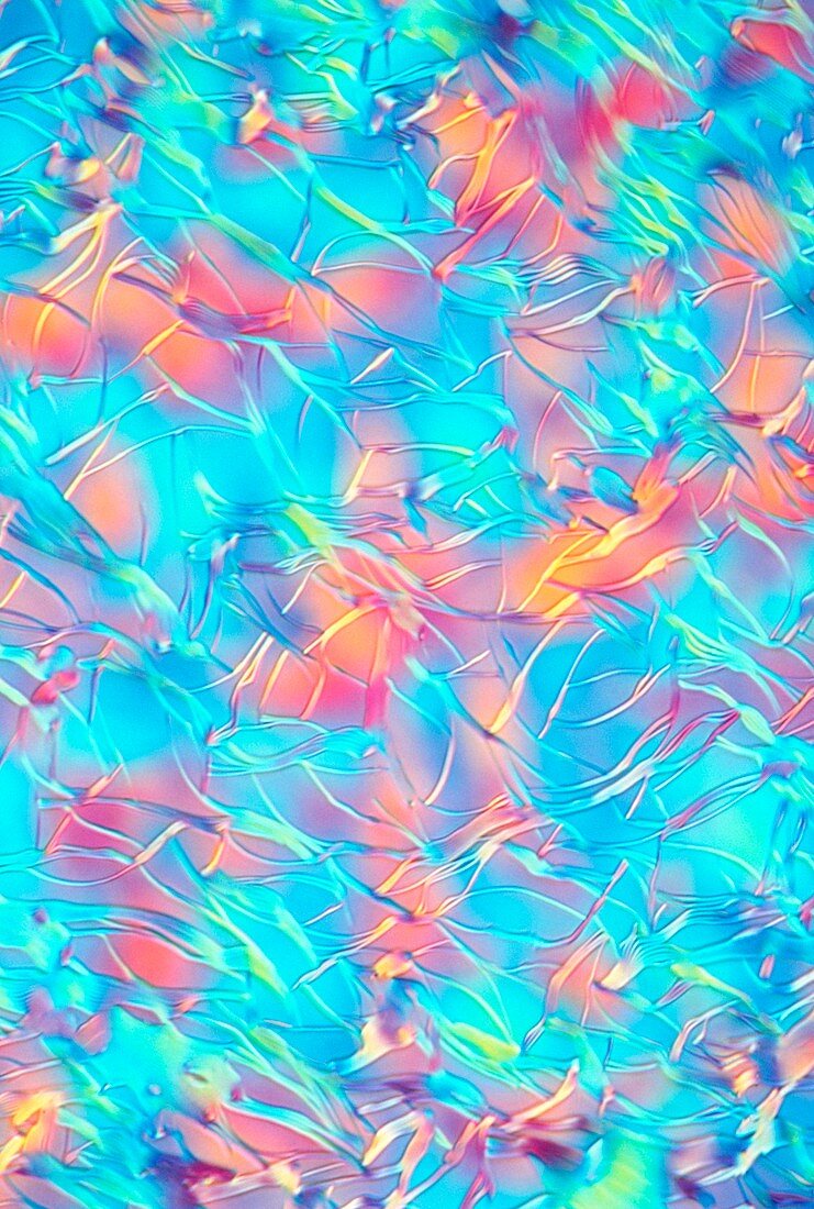 Light micrograph of cholesterol crystals