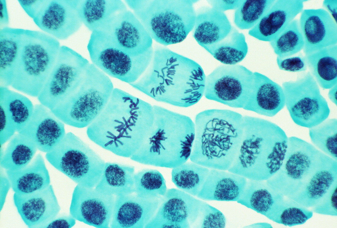 Plant cell mitosis,light micrograph