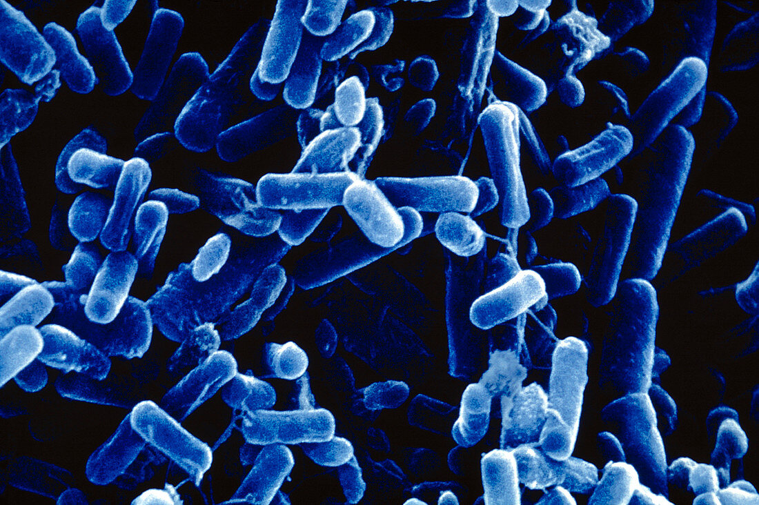 Pseudomonas bacteria in lung