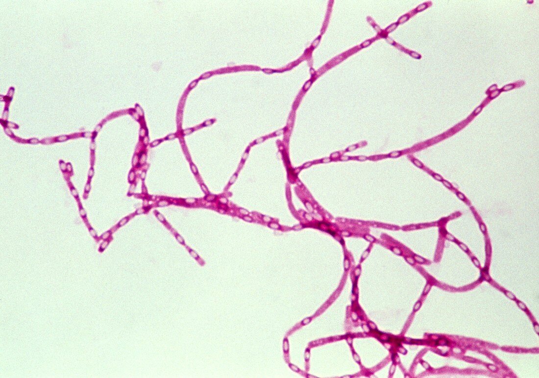 Anthrax bacteria,Bacillus anthracis
