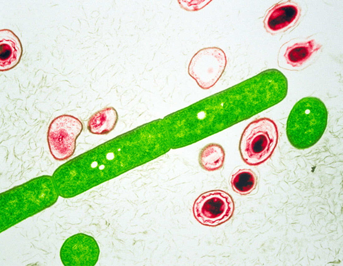 Anthrax bacteria,TEM