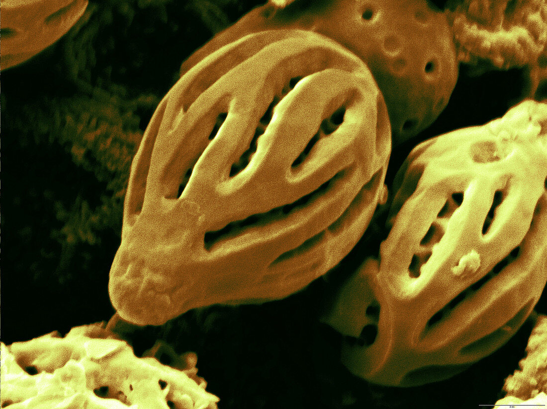 Ganoderma sinensis spores