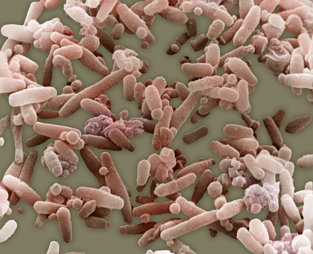 Bacteria cultured from alimentary tract