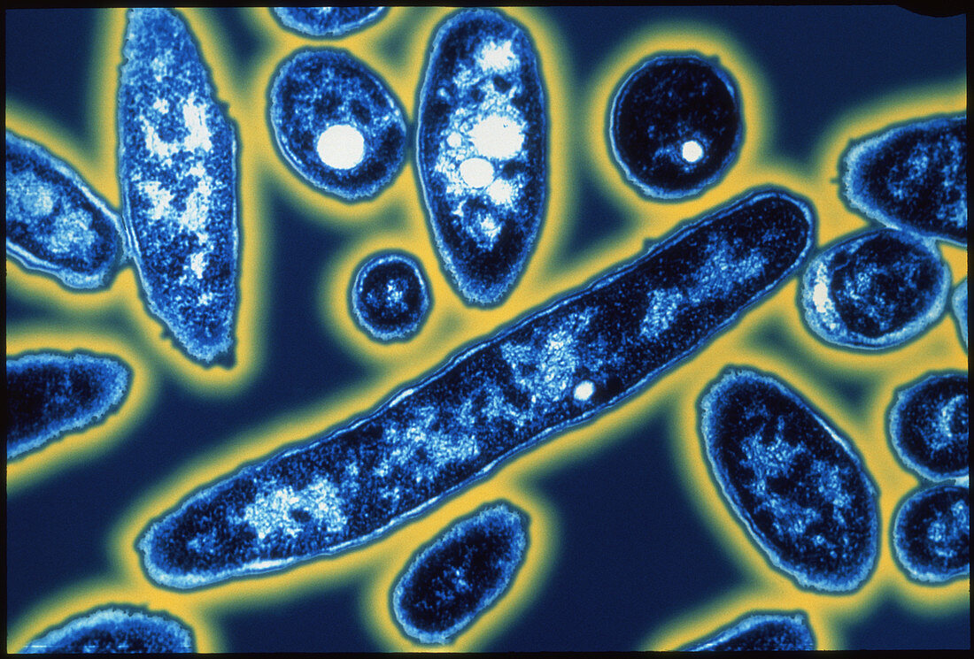 TEM of legionella bacteria