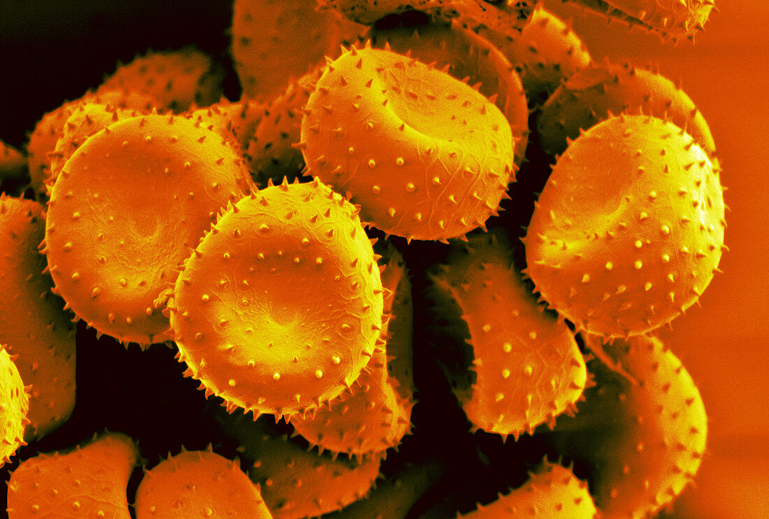 Pelargonium rust spores
