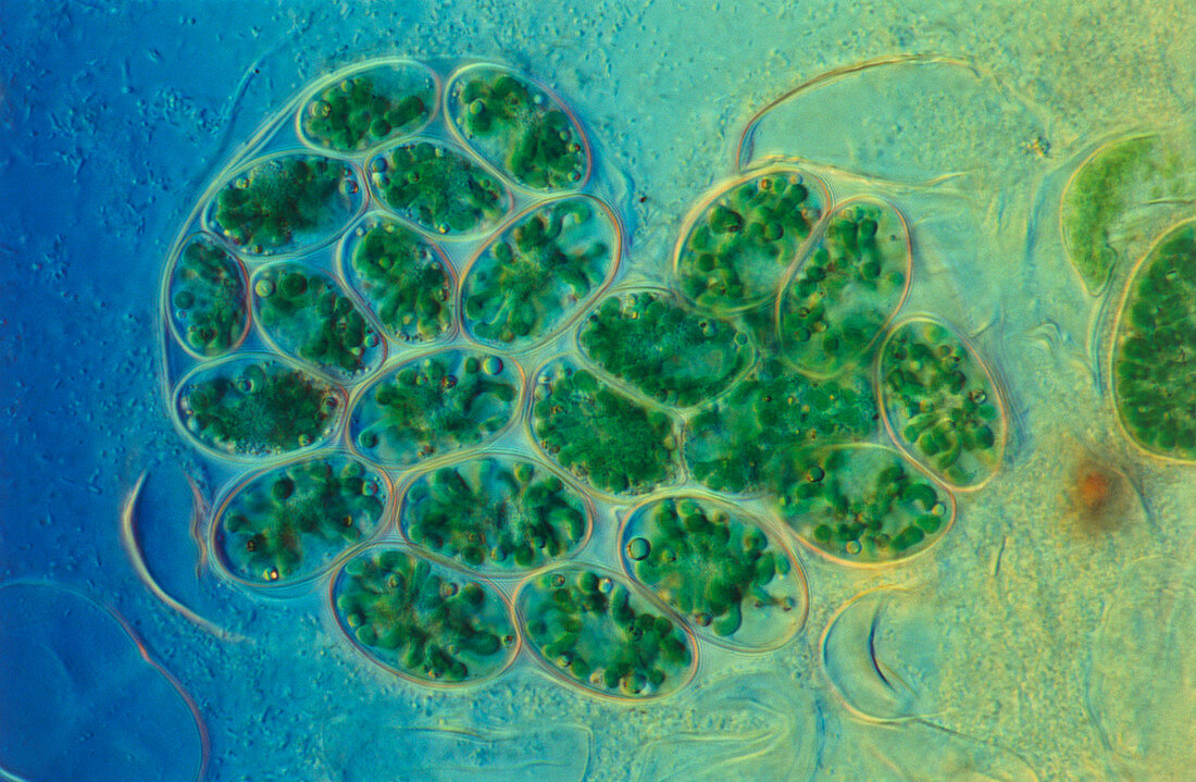 Glaucocystis alga with symbiotic algae