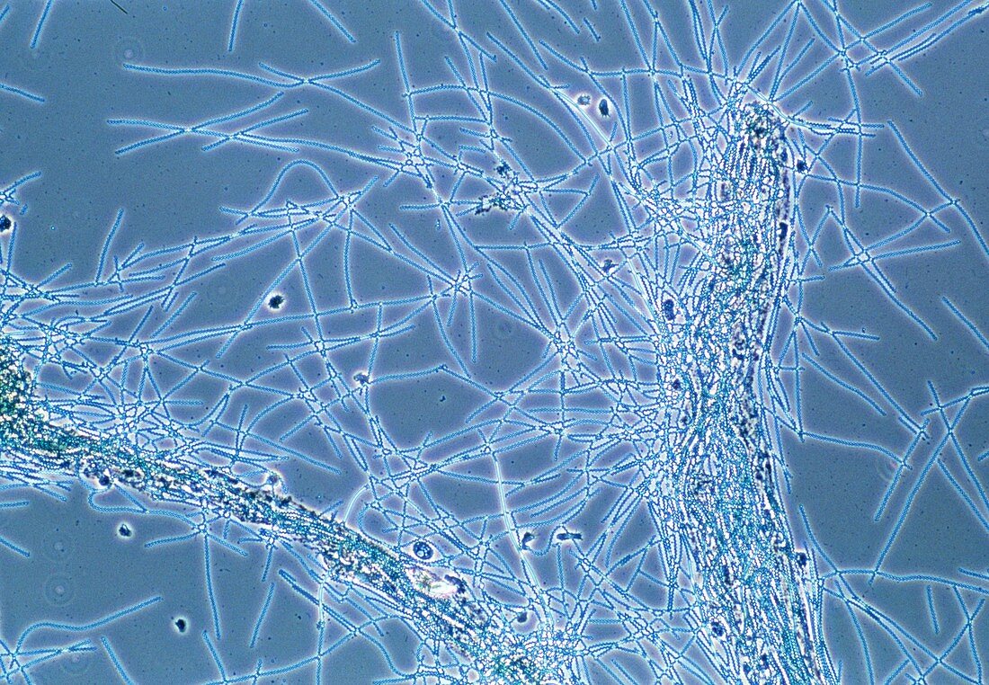 LM of blue-green algae,Spirulina major