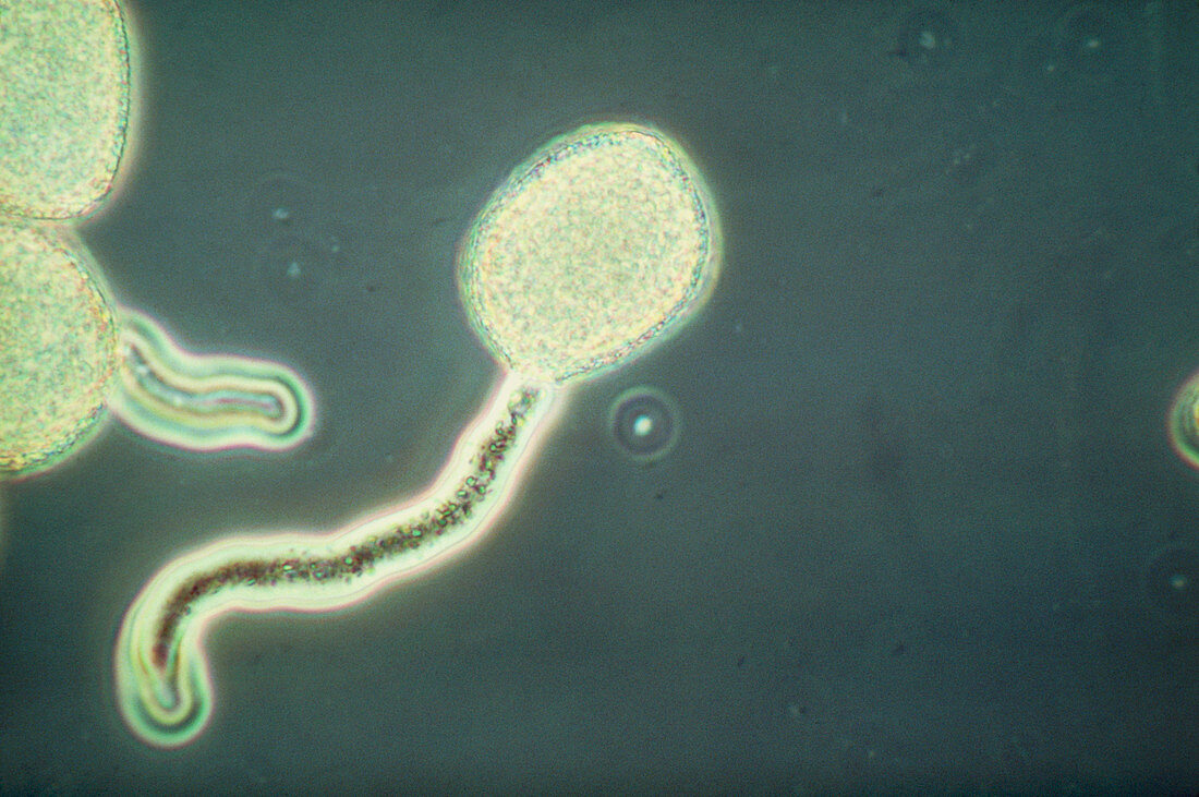Photomicrogrpah of a pollen tube