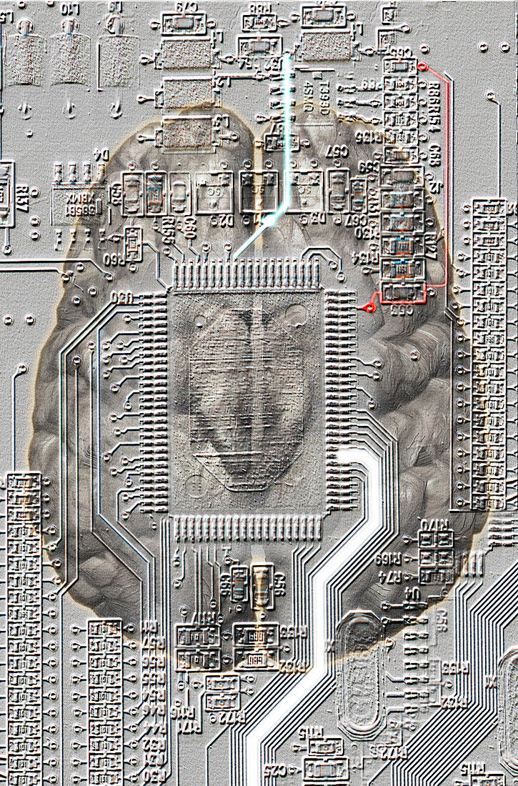 Brain Circuit