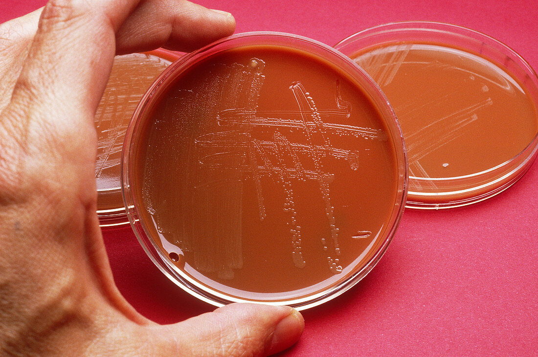 Petri dish with gonorrhea stain