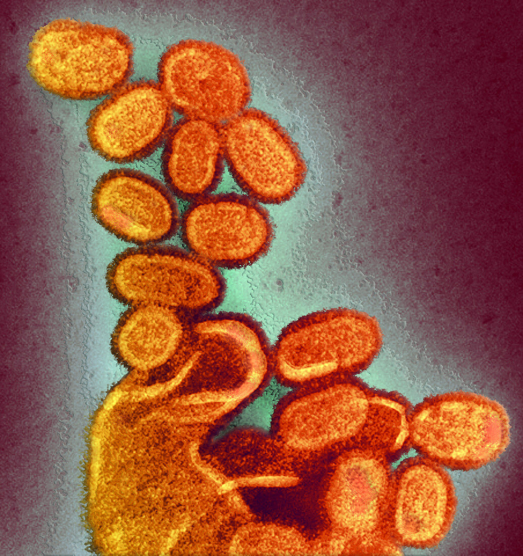 1918 Influenza Virions