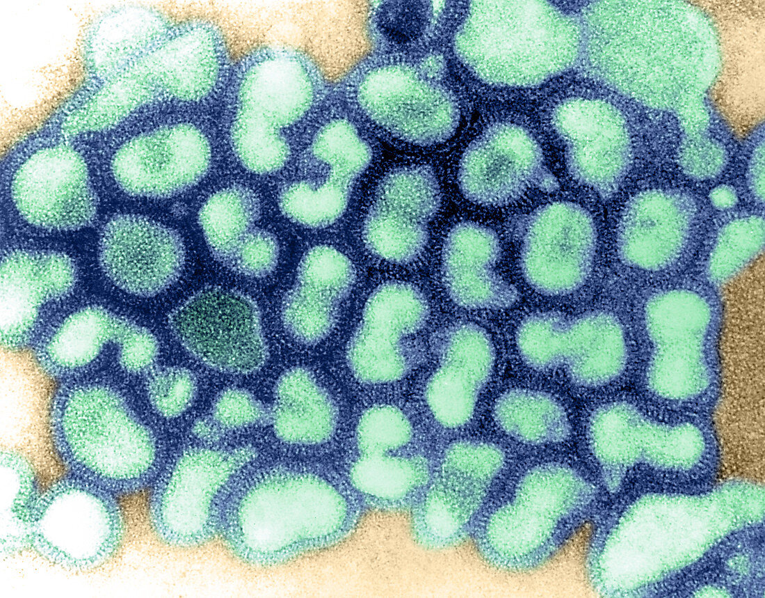 'Influenza virus,TEM'