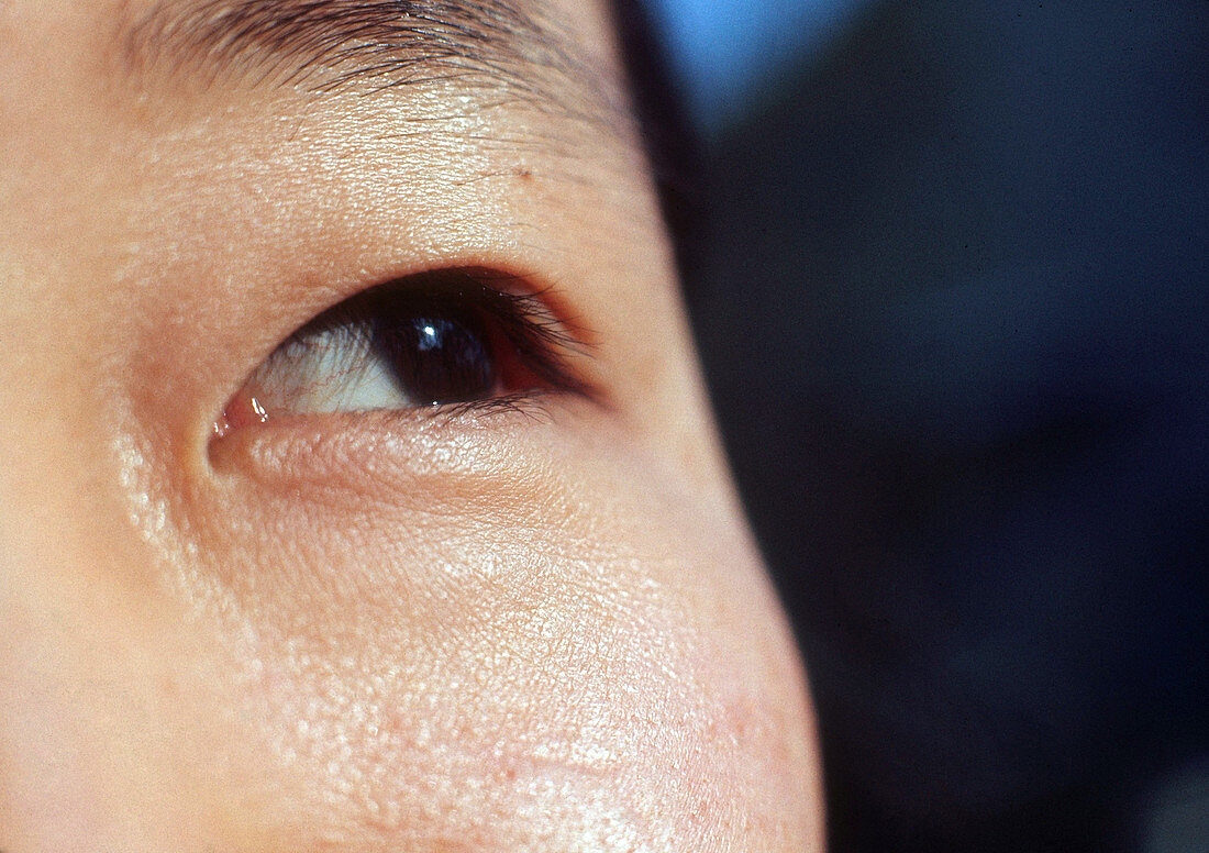 Japanese Female Eye