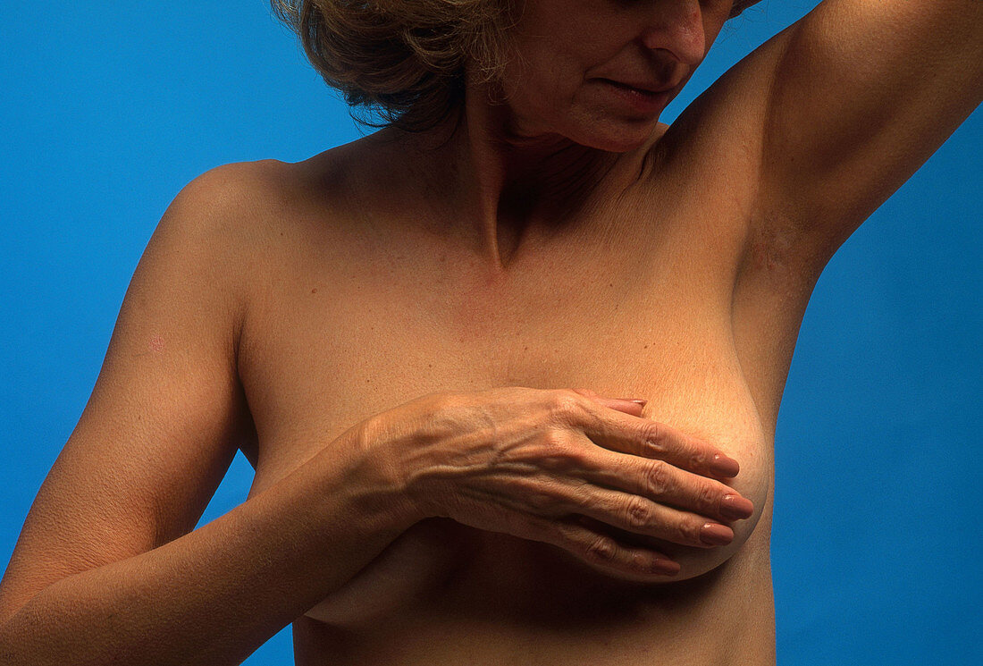 Breast Self Examination