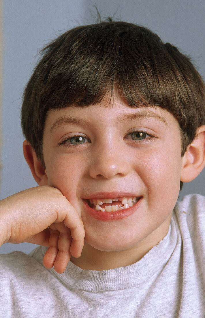 Boy Missing Tooth