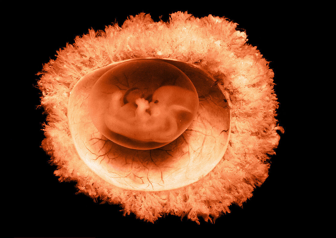 45 day old human embryo