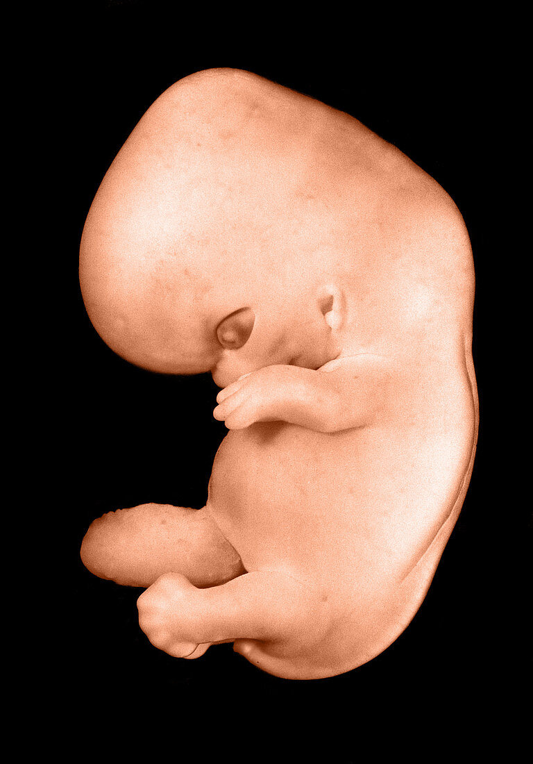 44 day old human embryo