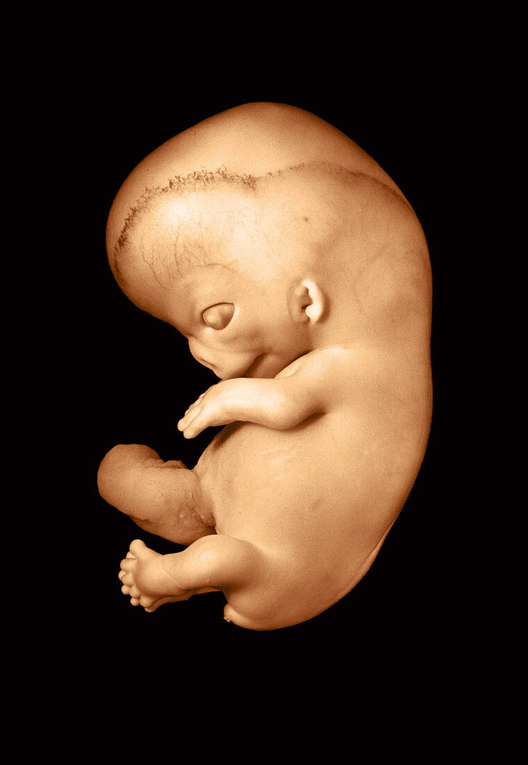 51 day old human fetus