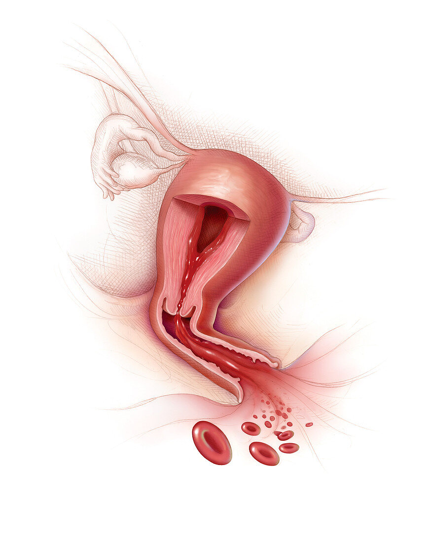 Menstruation Illustration