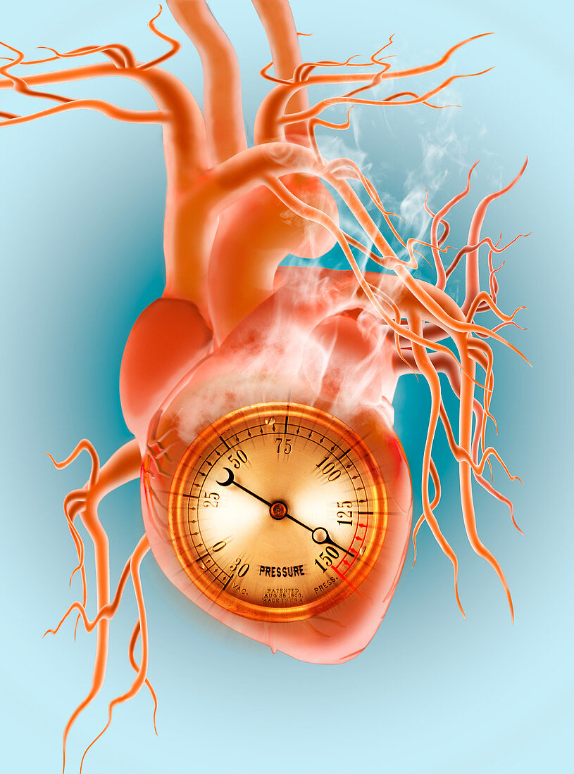 Pressure Gauge in Heart