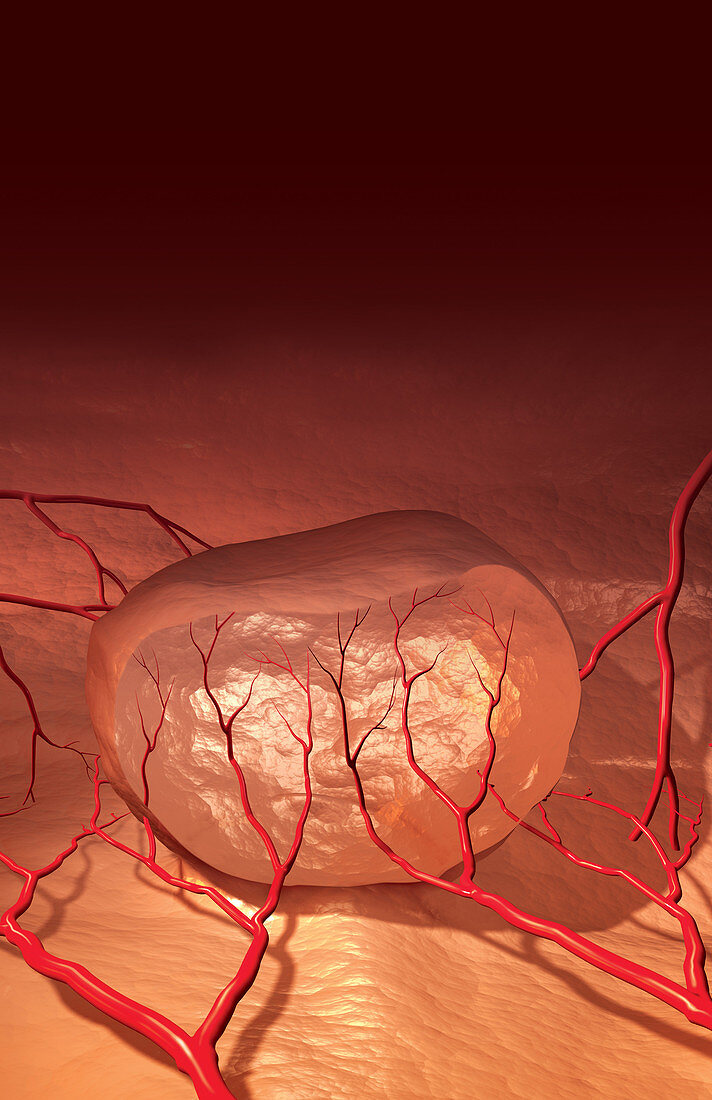 Illustration of Angiogenesis