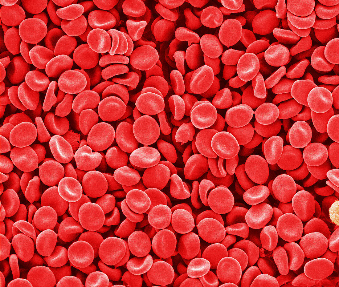 'Red Blood Cells,SEM'