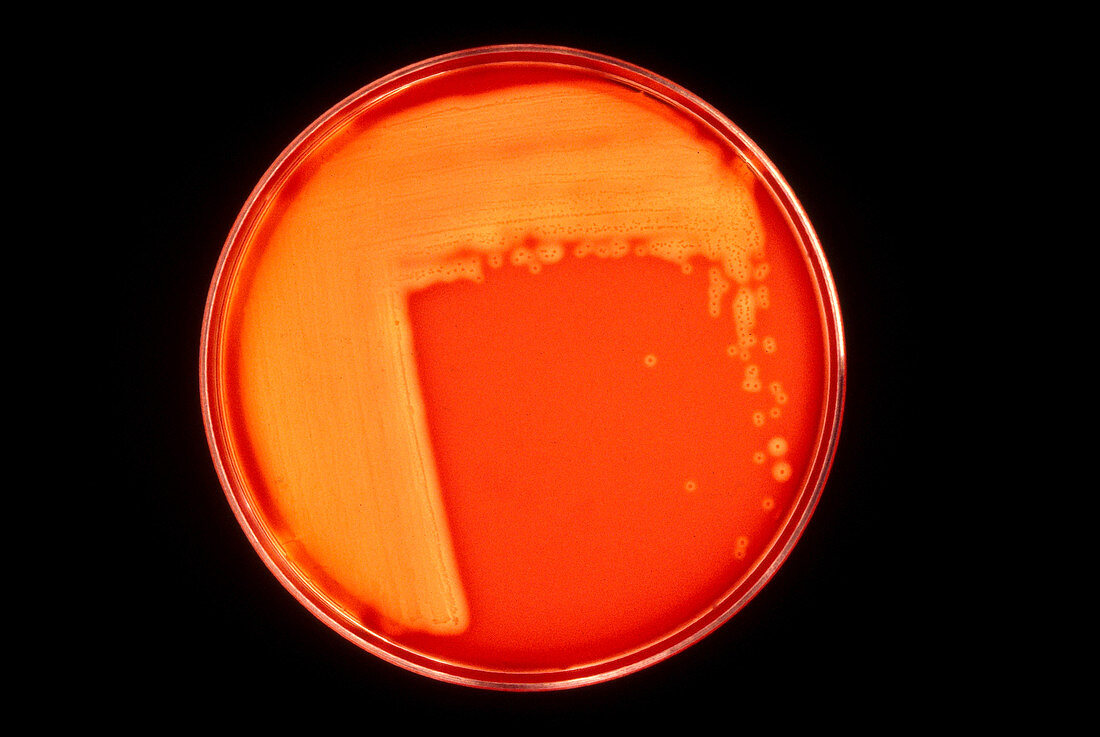 Streptococcus pyogenes