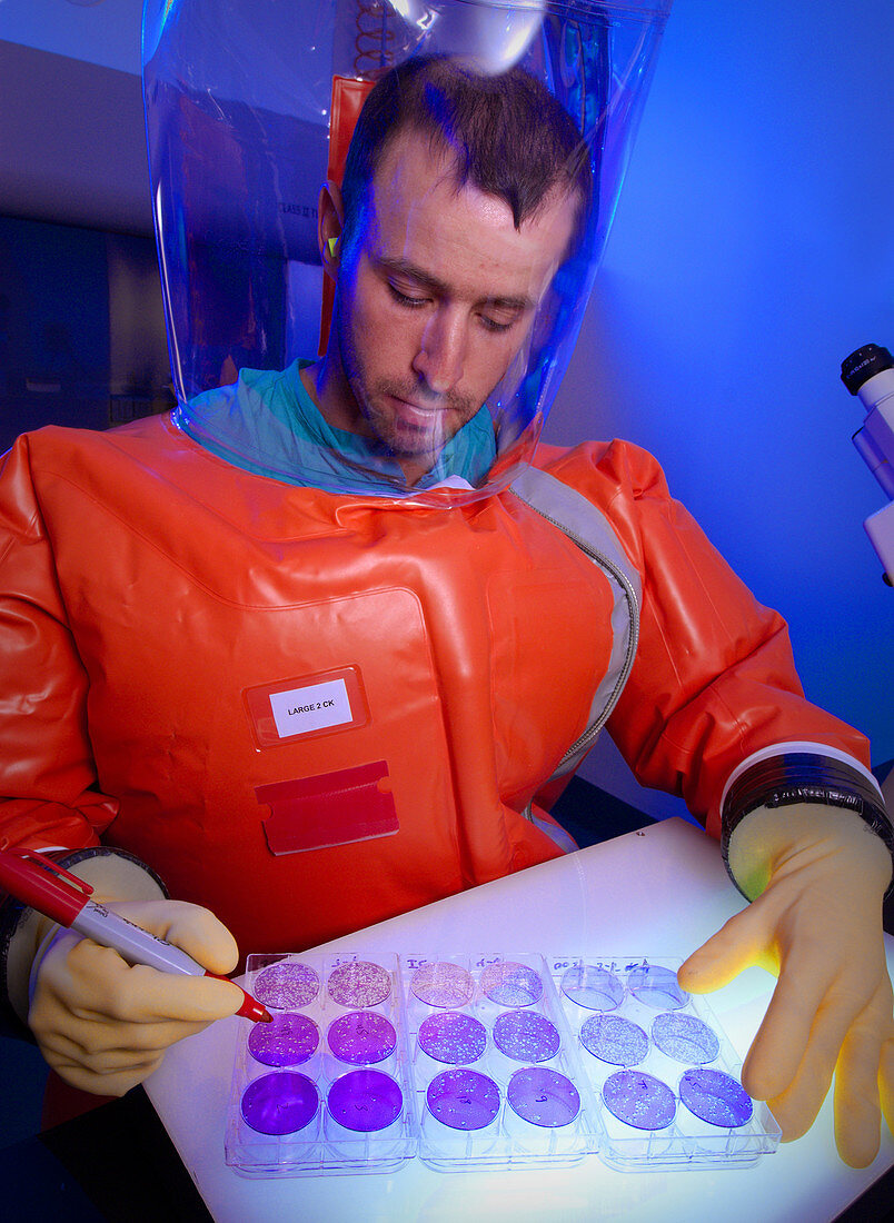 Microbiologist Handling Viral Plaques