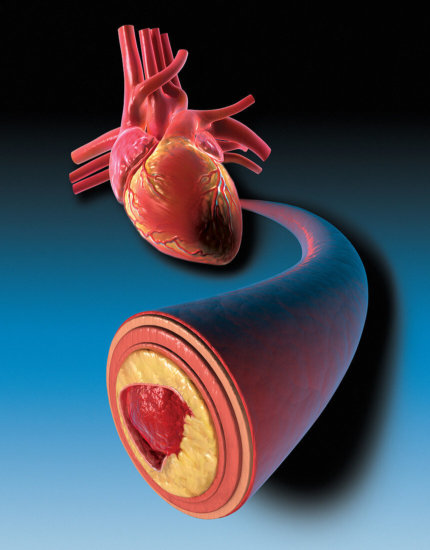 Coronary Artery Cross-Section