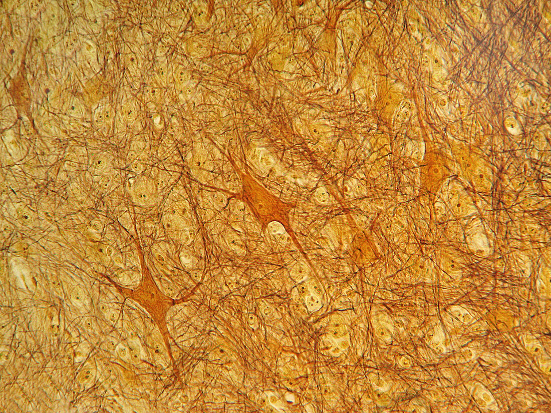 Spinal Cord Neurons