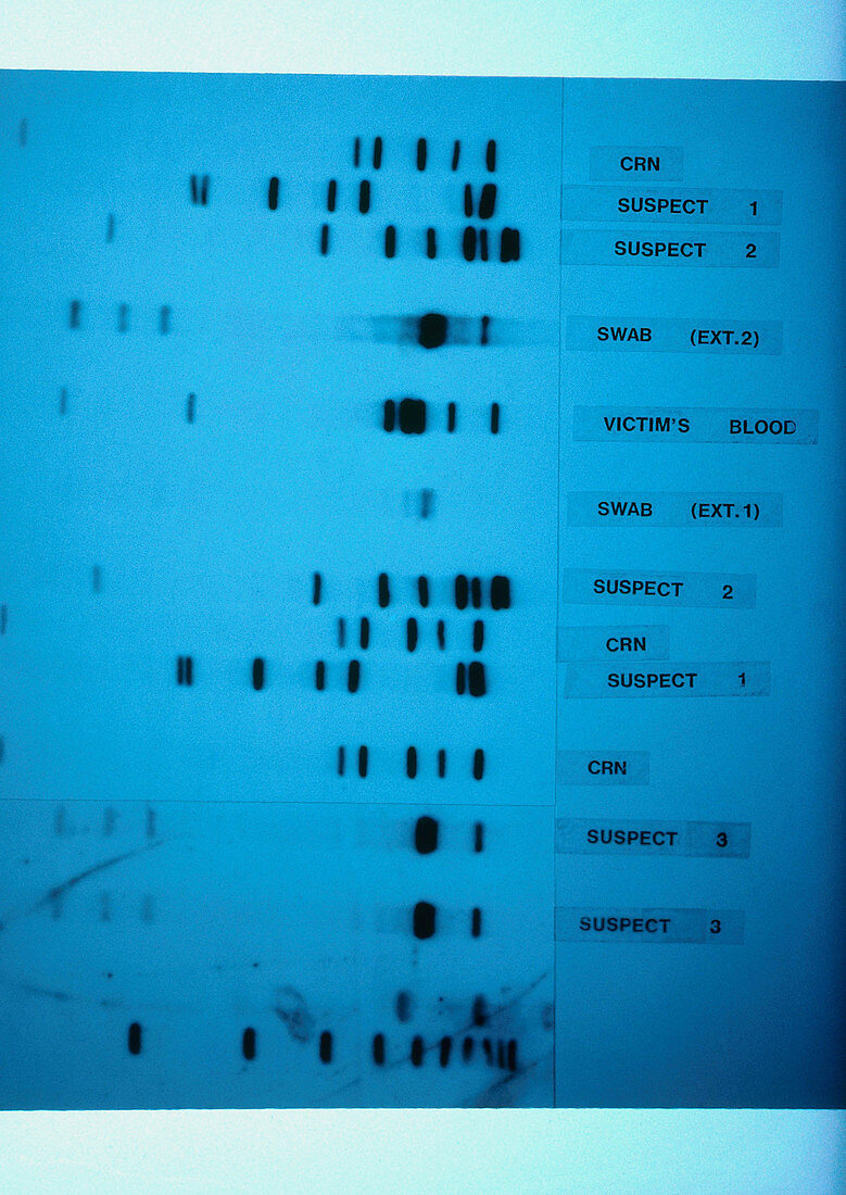 DNA Sequencing Gel