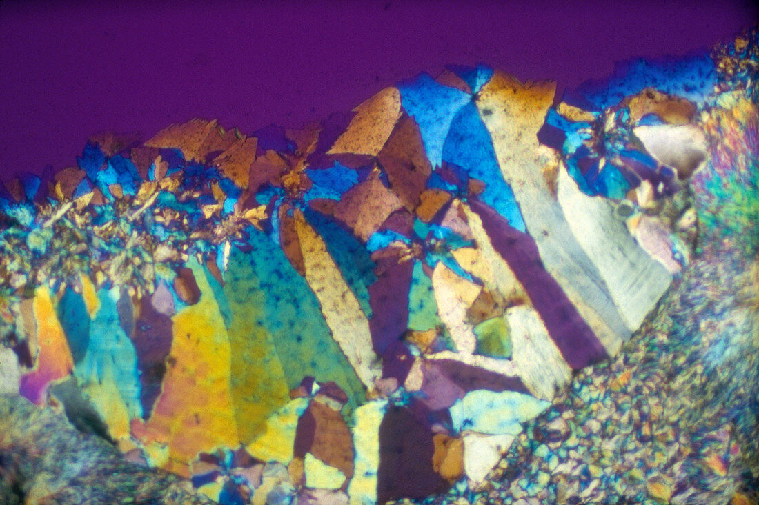 Coumadin,Polarized Light Micrograph