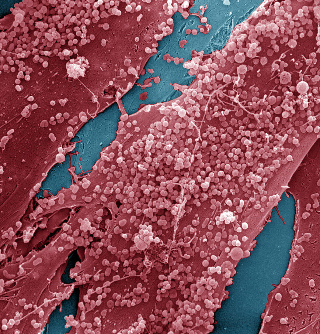 Human Skin Cell (SEM)