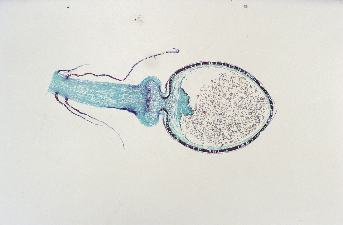 Sphagnum Sporophyte