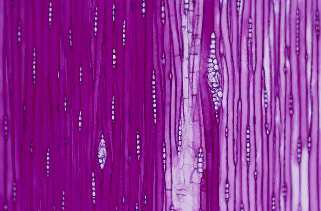 Pine Cells,Bright Field Microscopy