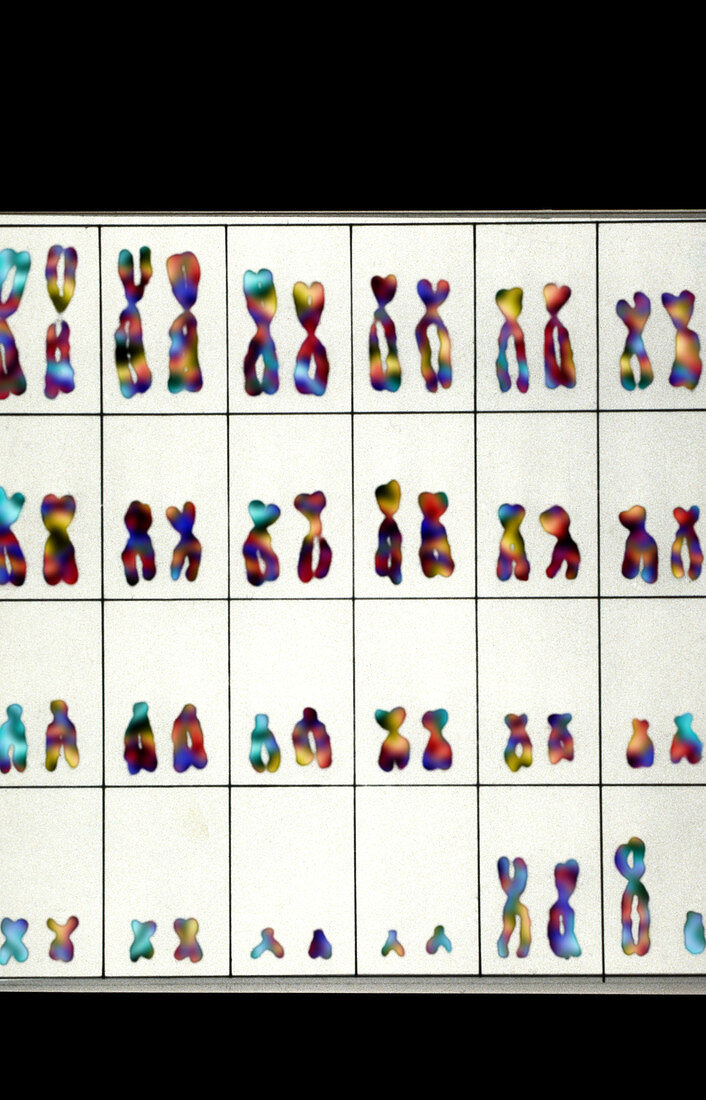 Karyotype of male chromosomes