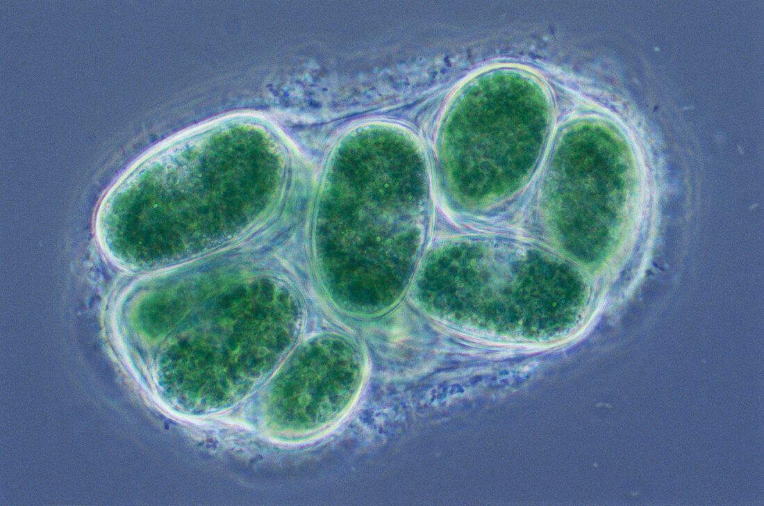 Glaucocystis sp. Algae,LM