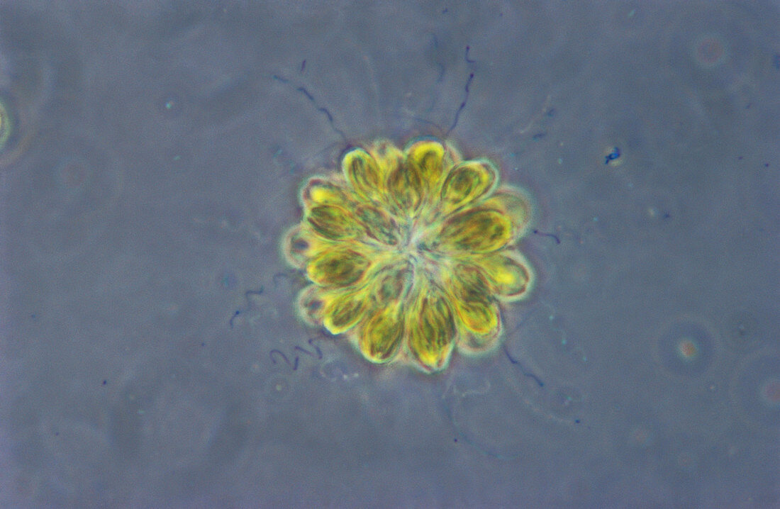 Synura Algae,LM