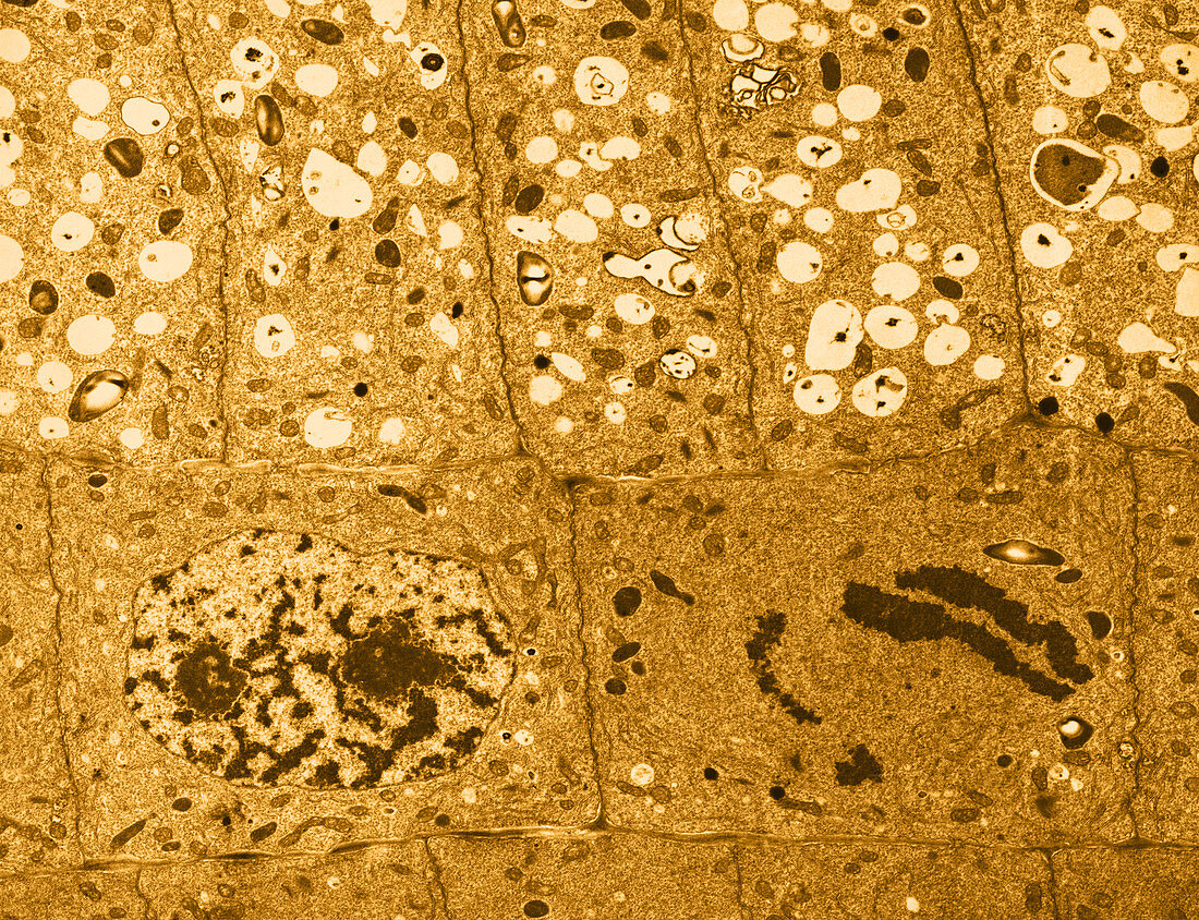 Barley,Root Tip Cells (TEM)