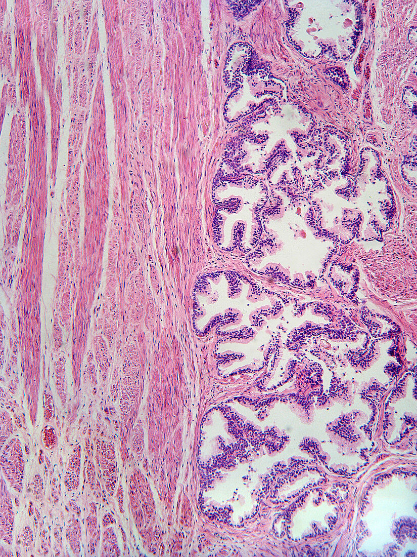 Human Prostate Tissue (LM)