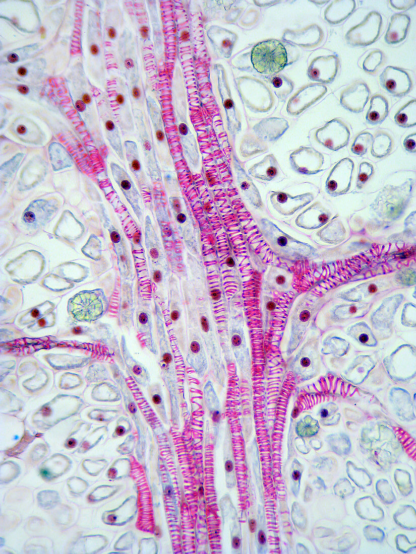 Spiral Tracheids in Mistletoe Leaf (LM)