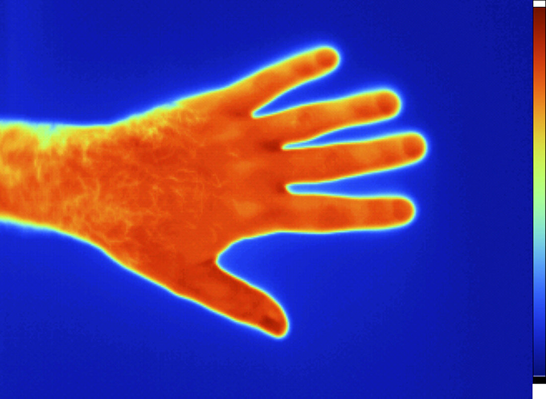 Thermogram of a Man's Hand